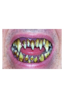 FX Fangs - Morlock