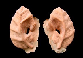 Dryad Ears